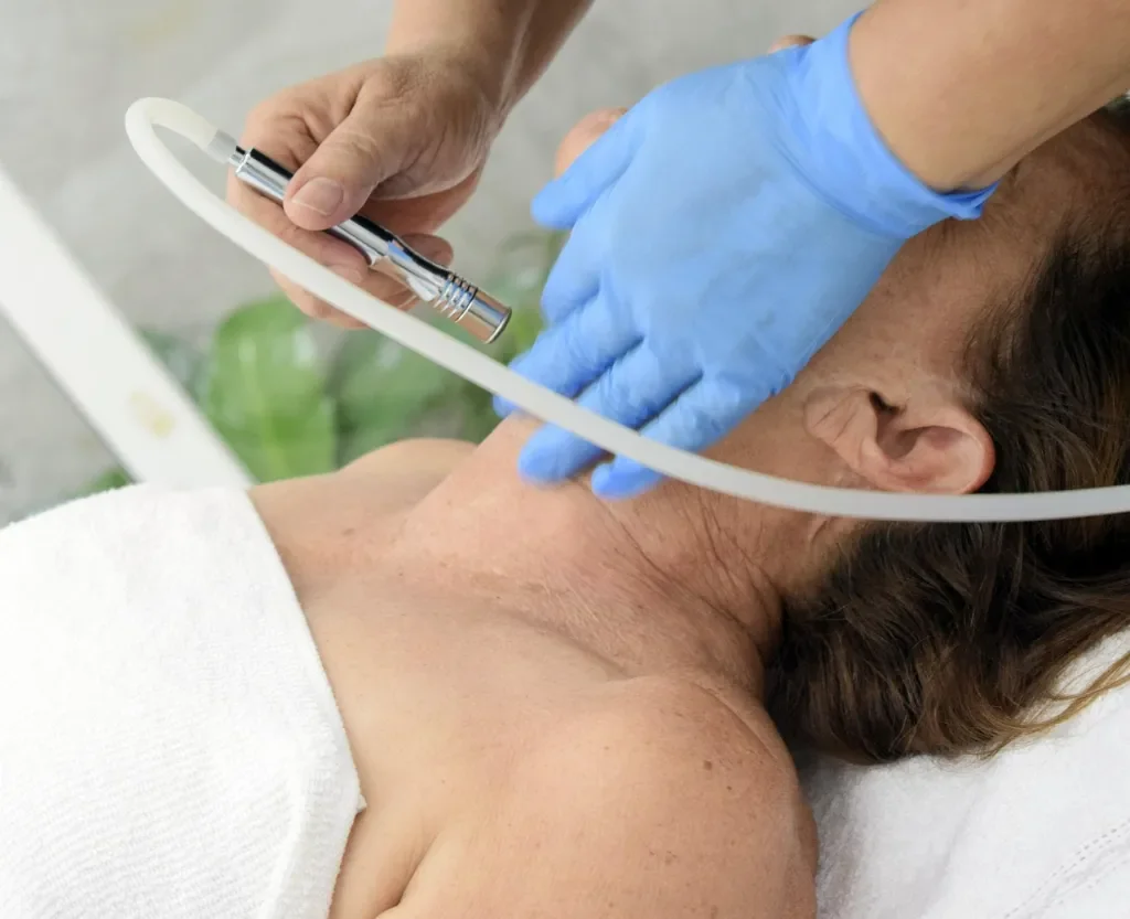 Mezoterapia igłowa – kiedy warto ją wykonać?